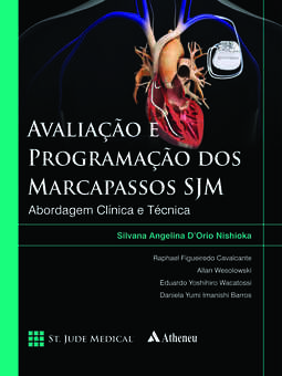 Avaliação e programação dos marcapassos SJM