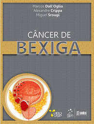 Câncer de Bexiga