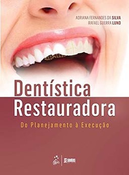 Dentística restauradora: Do planejamento à execução