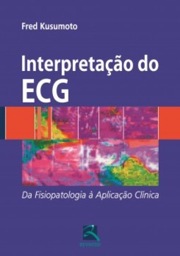Interpretação do ECG: da fisiopatologia à aplicação clínica