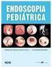 Endoscopia Pediátrica