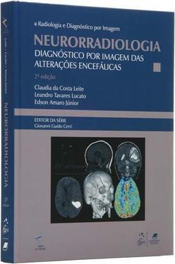 Neurorradiologia