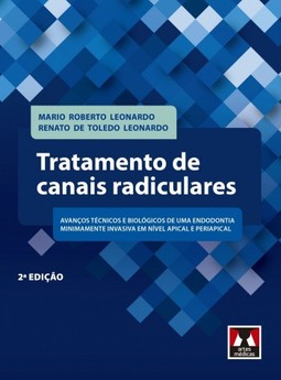 Tratamento de canais radiculares