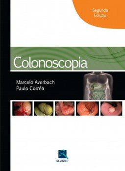 Colonoscopia