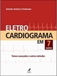 Eletrocardiograma Em 7 Aulas