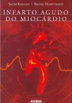 Infarto Agudo do Miocárdio