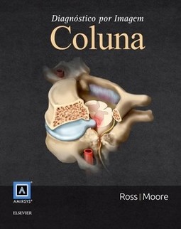 Diagnóstico por imagem: coluna