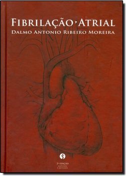 Fibrilação Atrial