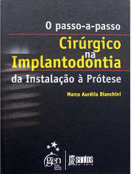 O passo a passo cirúrgico na implantodontia: Da instalação à prótese