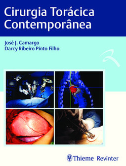 Cirurgia torácica contemporânea
