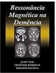 Ressonância Magnética na Demência