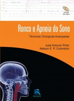 Ronco e apneia do sono: técnicas cirúrgicas avançadas