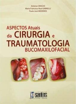 Aspectos Atuais da Cirurgia e Traumologia Bucomaxilofacial