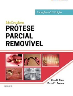 McCracken - Prótese parcial removível