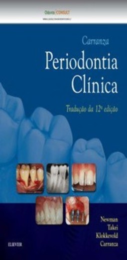 Carranza - Periodontia clínica