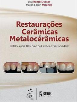 Restaurações Cerâmicas Matalocerâmicas