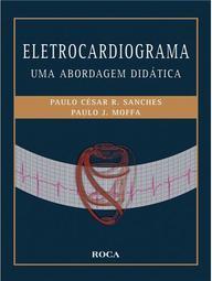 Eletrocardiograma: Uma abordagem didática