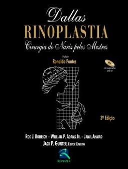 Rinoplastia: cirurgia do nariz pelos mestres