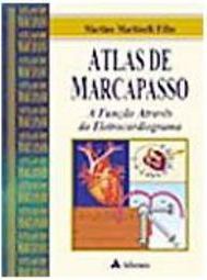 Atlas de Marcapasso: a Função Através do Eletrocardiograma