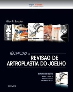 Técnicas de revisão de artroplastia do joelho