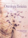 Conceitos e rotinas em oncologia torácica
