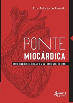 Ponte miocárdica: implicações clínicas e anatomopatológicas