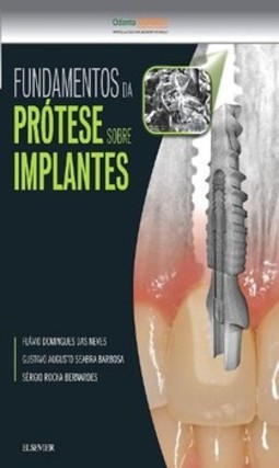 Fundamentos da prótese sobre implantes