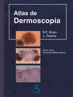 Atlas de dermoscopia