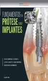 Fundamentos da prótese sobre implantes