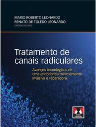 Tratamento de Canais Radiculares