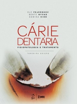 Cárie dentária: Fisiopatologia e tratamento