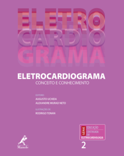 Eletrocardiograma: Conceito e conhecimento