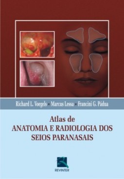 Atlas de anatomia e radiologia dos seios paranasais