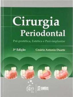 Cirurgia Periodontal
