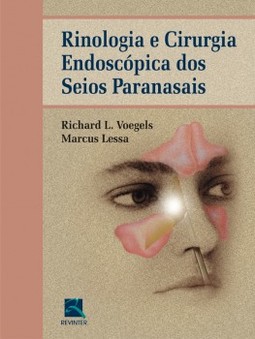 Rinologia e cirurgia endoscópica dos seios paranasais