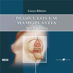 Pedículos em Mamoplastia