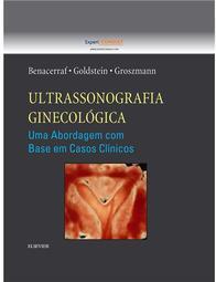 Ultrassonografia ginecológica