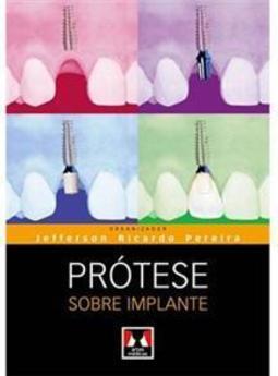 Prótese Sobre Implante