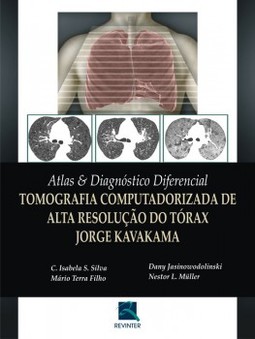 Atlas e diagnóstico diferencial: tomografia computadorizada de alta resolução do tórax - Jorge Kavakama