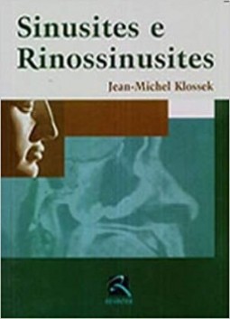 Sinusites e rinossinusites