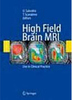 High Field Brain MRI - Importado