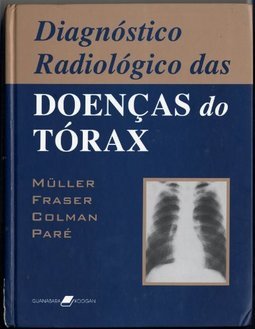 Diagnóstico Radiológico das Doenças do Tórax