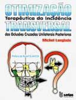 Otimização Terapêutica da Incidência Transversal - IMPORTADO