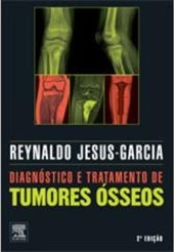 DIAGNÓSTICO E TRATAMENTO DE TUMORES ÓSSEOS