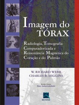 Imagem do tórax: radiologia, tomografia computadorizada e ressonância magnética do coração e do pulmão