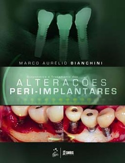Diagnóstico e tratamento das alterações peri-implantares