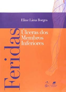 Feridas: Úlceras dos membros inferiores