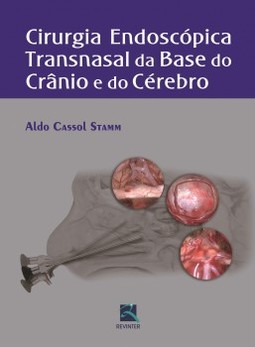 Cirurgia endoscópica transnasal da base do crânio e do cérebro
