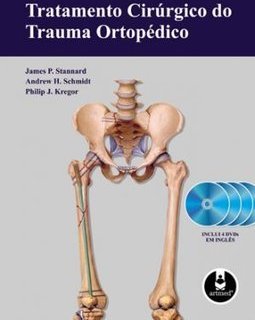 TRATAMENTO CIRURGICO DO TRAUMA ORTOPEDICO