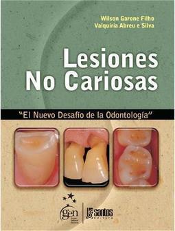 Lesiones no Cariosas